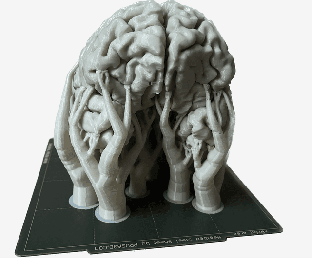 Brain 