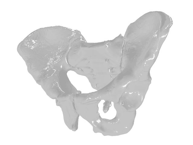 Pelvis