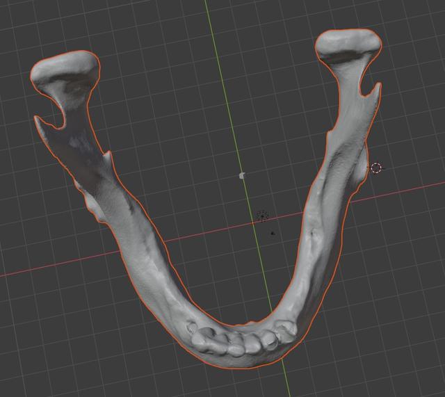 Thumbnail of 4 Mandibula Im G2