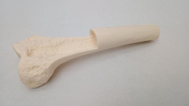 Thumbnail of 2 Femur Printed1