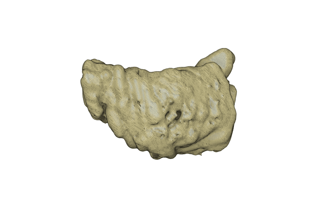 Thumbnail of Left Ventricle Volume