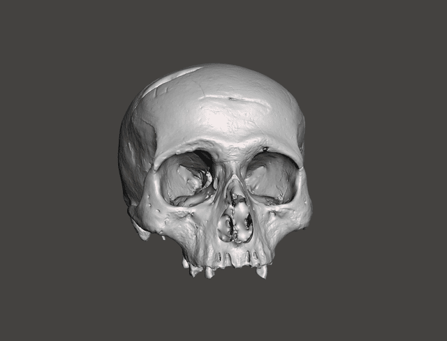 Fallen Soldier's Skull 1809