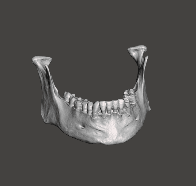 Mandible Scanned