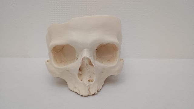 Thumbnail of 3 Skull Printed1