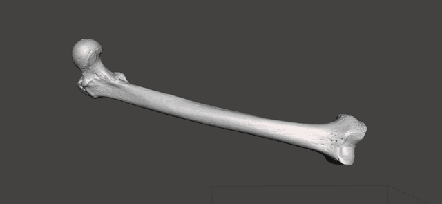 Thumbnail of Femur 2