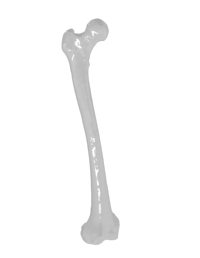 Femur