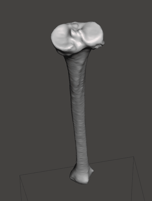 Tibia