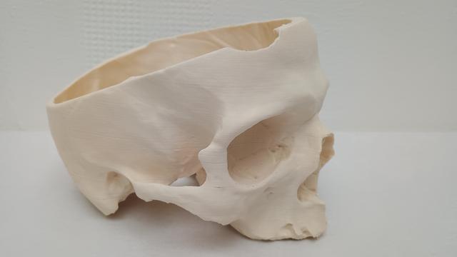 Thumbnail of 3 Skull Printed2