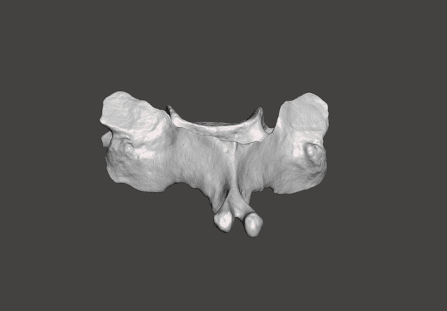 Vertebra C5