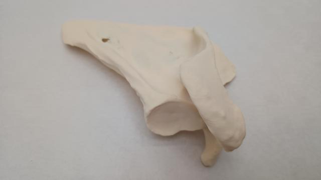 Thumbnail of 1 Scapula Printed2