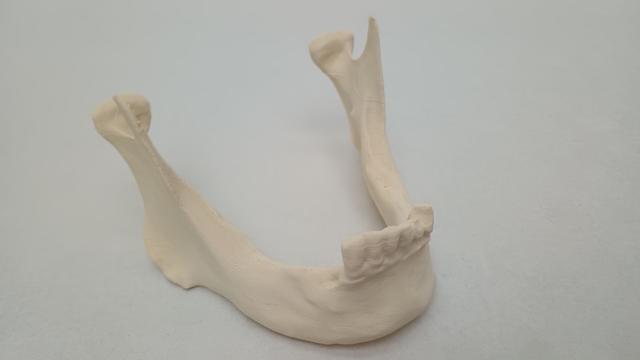 Thumbnail of 4 Mandibula Printed2