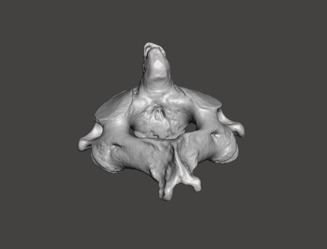 Vertebra C2