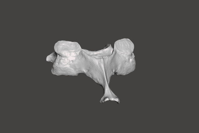 Vertebra C6