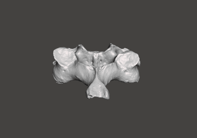 Vertebra C3