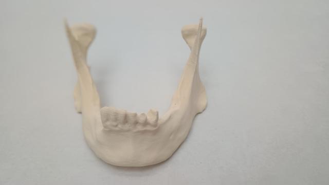 Thumbnail of 4 Mandibula Printed1