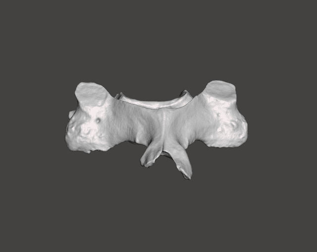 Vertebra C4