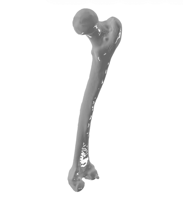 Femur