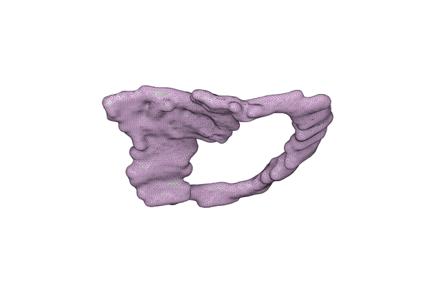 Thumbnail of Mitral Valve