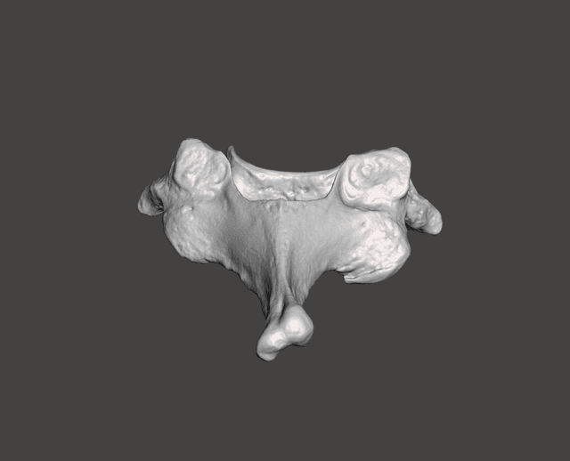 Vertebra C7