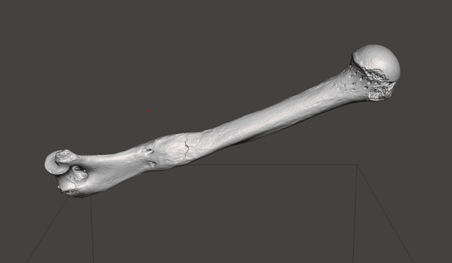 Humerus Inflammation 2