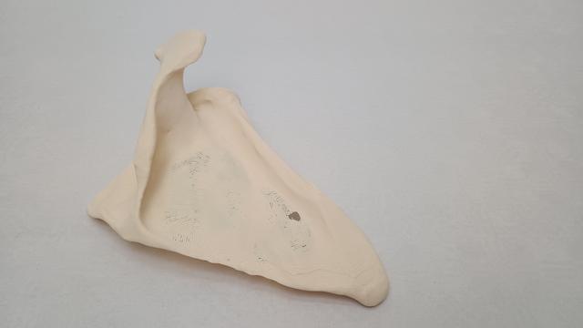 Thumbnail of 1 Scapula Printed1