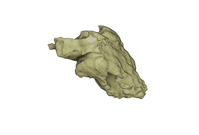 Thumbnail of Left Ventricle