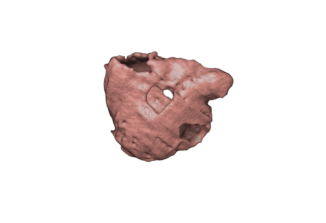 Thumbnail of Right Ventricle Chamber