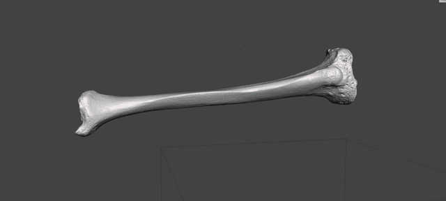 Tibia