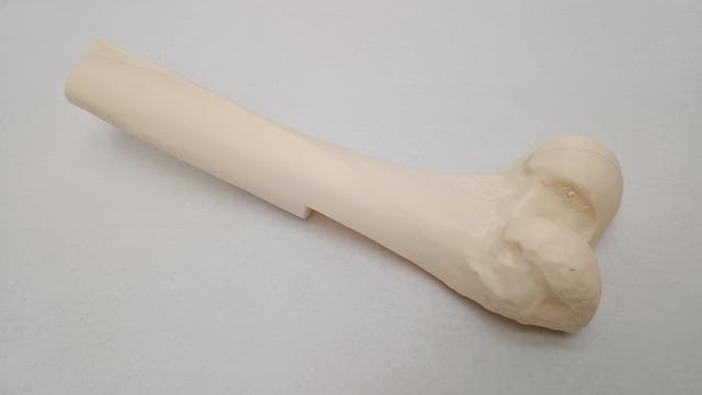 Thumbnail of 2 Femur Printed2