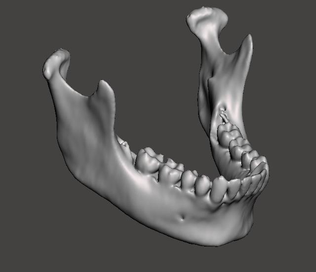 Mandible