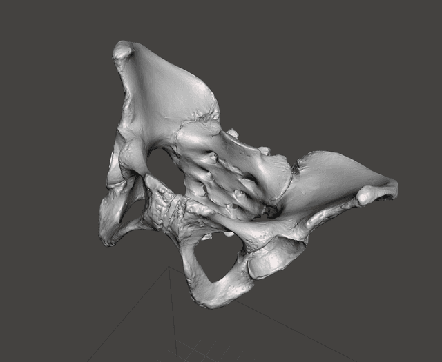 Pelvis