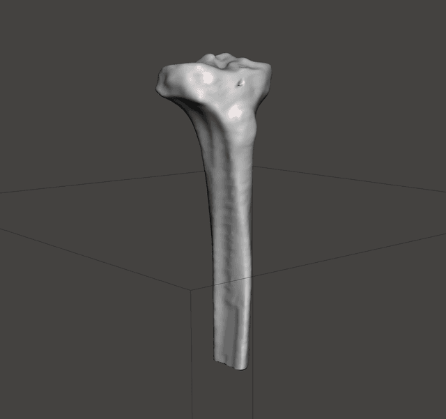 Tibia